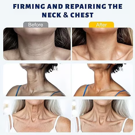 ✨ Caezor™ Youth Boost Neck Cream for Smoother-Looking Skin