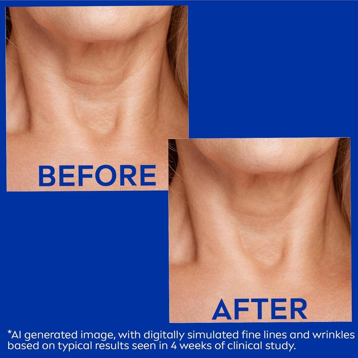 ✨ Caezor™ Youth Boost Neck Cream for Smoother-Looking Skin