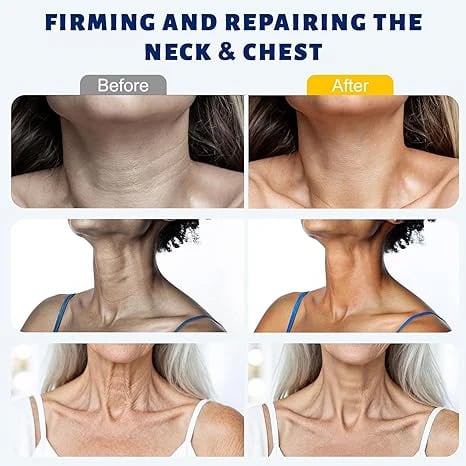 ✨ Caezor™ Youth Boost Neck Cream for Smoother-Looking Skin